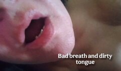 Bad breath and dirty tongue 2