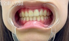 Amateur Oral Fetish – A Local TV Announcer Reveals the Inside of Her Mouth in Complete Detail for the First Time Ever.