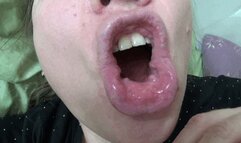 Morning bad breath and dirty tongue 2