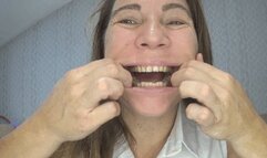 Look at my mouth and teeth so close