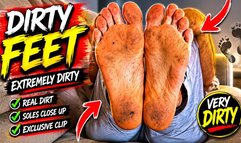 Dirty feet!