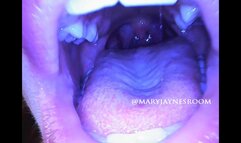 Krystal Kitten Endoscope Mouth NO AUDIO Video 1 - WMV