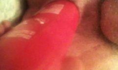 anal gape