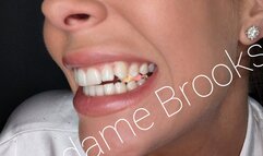 Nikki Brooks - Tiny Medical Problem (1080-HD)