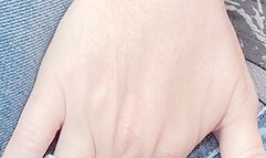 Lexi has a real accident