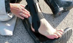 Severe leg pain MP4(1280*720)HD