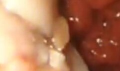 Whole chicken digestion endoscopy 1080HD