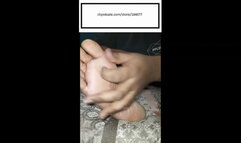 Delicious Close Up of Athletes foot