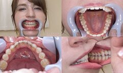 June - Watching Inside mouth of Japanese cute girl bite-236-1 - wmv 1080p