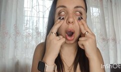 The horrible look of an unhealthy face, " WHITE EYES"