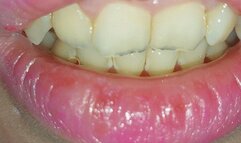 mint candy in my mouth