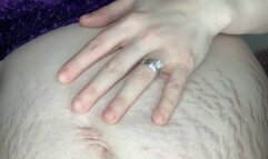 MastersLBS 6 week pregnant stretch marks