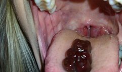 Gummy bear in spit strings