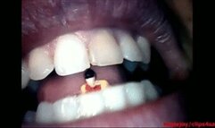 Endoscopic devouring