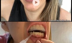 BURCHING WITH A DIRTY MOUTH AND Teeth Whitening