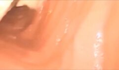 Very problematic medical vore anal exploration 720HD