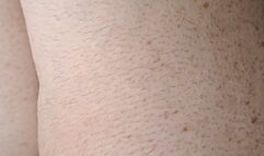 COUNT THE FRECKLES AND YOU SEE THE BLACK HAIR GROWING IN