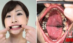 Teeth Inspection Chronicles: Dive into Yume Hidaka's Enigmatic Oral Realm