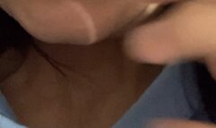 Crooked teeth and dirty gums