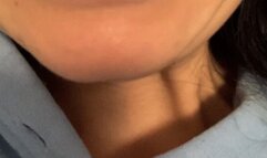 Disgusting crooked teeth