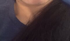 Cracked lips and teeth