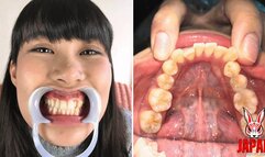 Dental Sensation: Brushing, Sensitivity, and Intrigue, Kotomi Shinozaki