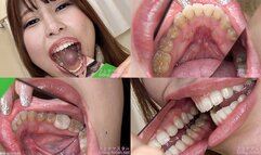 Miu - Watching Inside mouth of Japanese cute girl bite-253-1 - 1080p