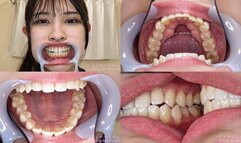 Miyu - Watching Inside mouth of Japanese cute girl bite-257-1