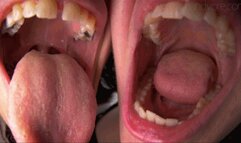 Your Two Aunties Want To Gobble You All Up For Breakfast (POV Vore)