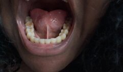 Getting all the LITTLE PEOPLE Out of My TEETH