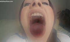 Ivory Digests Her Orthodontist