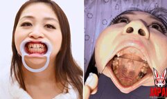 Dental Exploration: Tooth Filling missing Rin Ryomiya's Adventure