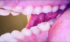 Endoscope - My First Mouth Adventure