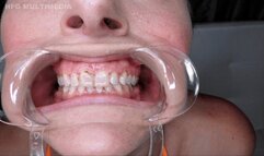 Kitty Quinn: Mouth Tour - MP4 SD