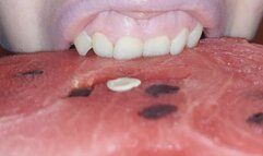 I destroy a watermelon with my teeth