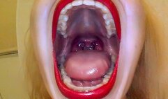 Yawning Endoscopy CUSTOM