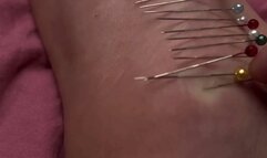 sticking needles in my feet