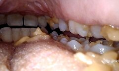 Trapped in a noodles