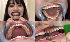 Yukino - Watching Inside mouth of Japanese cute girl bite-261-1 - MOV