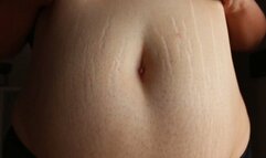 Belly Stretch Marks