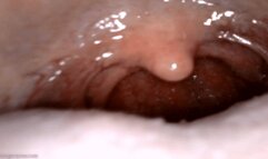 yawning uvula endoscopy