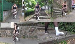 About My Bunion Part2