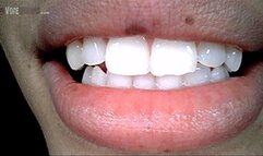 Beverly's Endoscope Mouth Tour,with Audio 720 HD Giantess Vore