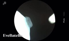 Extreme Up-Close Ear Wax Extraction And Inspection