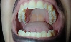 Roof of my big mouth