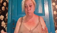 Hiccups from overeating WMV(1280*720)HD