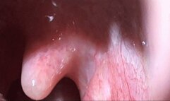 A Really Close Inspection Part 2