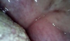 throat endoscope and candy swallow