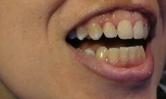 Scratch and Floss Dirty Teeth