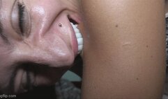 Marks on skin-Special request